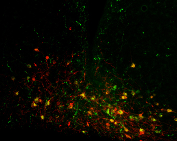 A coronal section through the arcuate nucleus of the hypothalamus